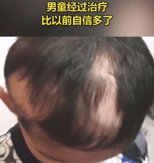 怀孕头发变多是男孩吗