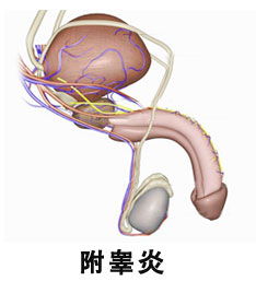 附睾炎挂什么科室看