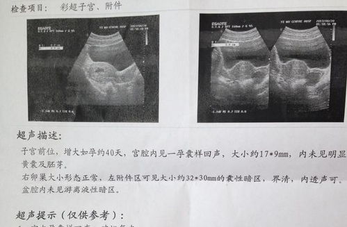 胎儿为什么趴着呢