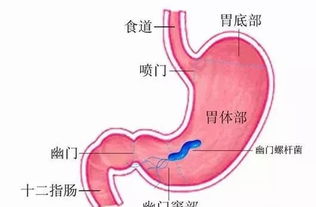 做胃幽门螺旋杆菌检查需要空腹吗