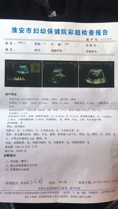 怀孕21周了可以去预约做四维彩超检查吗