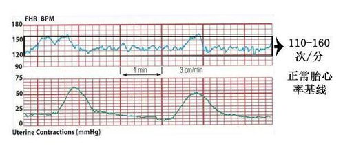 B超显示胎心率和胎心仪测出的差别怎么那么大?