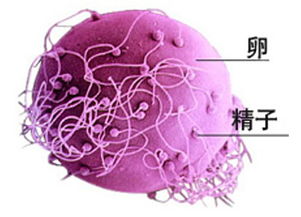 无精症射出来的是什么