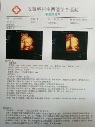 四维彩超上的efw是什么意思