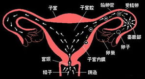 右侧输卵管通而不畅会宫外孕吗