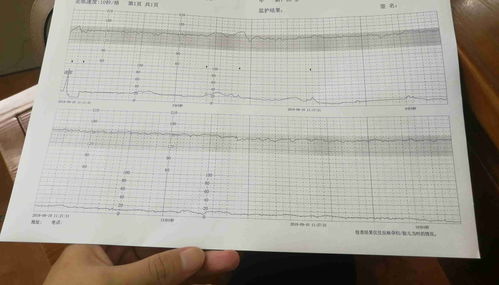 怀孕32+5天听胎心时在170左右正常吗？