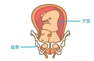 胎位不正的最佳纠正时间是什么时候?