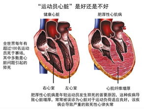 宝宝先天性心脏病缺损可以自己长好吗？