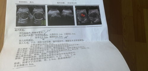 怀孕32周胎儿各项正常值是多少呀？超声显示单胎(头位)什么意思？