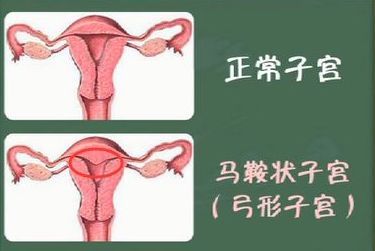 孕妈妈胎位不正能顺产吗?胎位不正怎么办呢