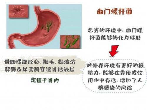 一个的幽门螺旋杆菌阳性会传染给家人吗