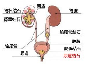 怎么取下来，镶活动假牙好吗，活动假牙视频