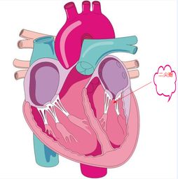 心脏彩超，说是三尖瓣.二尖瓣反流，是什么意思