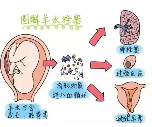 羊水超过多少范围就注意了胎儿