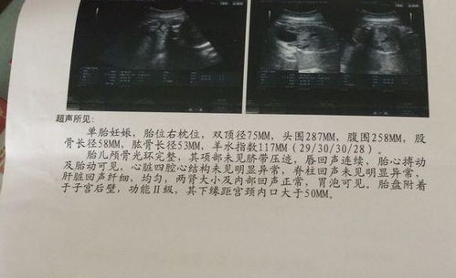 孕24周四维彩超上双肾未见分离是什么意思