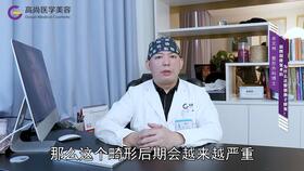 兔唇和唇腭裂的区别图片