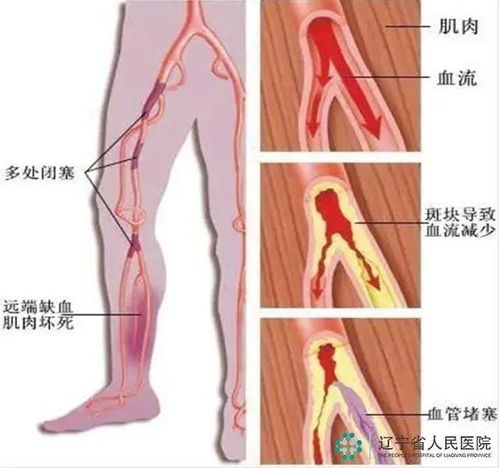 关于骨龄偏大的问题