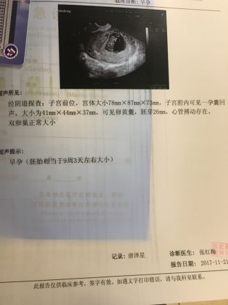 怀孕37天做Ba超可看到孕囊吗？