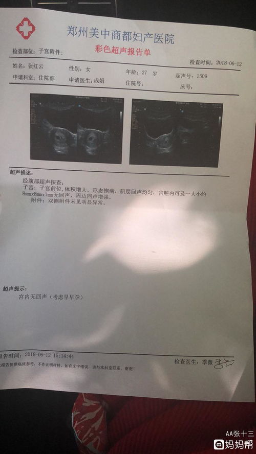 怀孕37天做Ba超可看到孕囊吗？