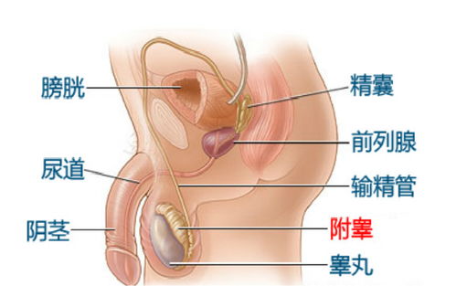 慢性附睾炎能根治吗