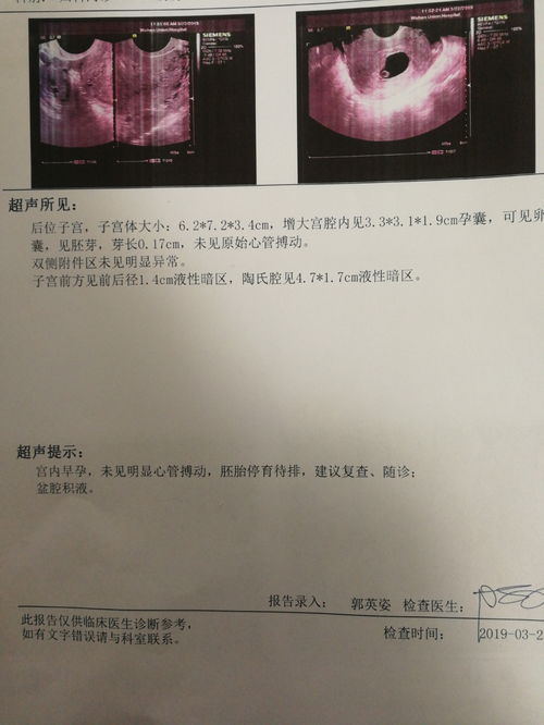 怀孕45天有卵黄囊就会有胎芽胎心吗