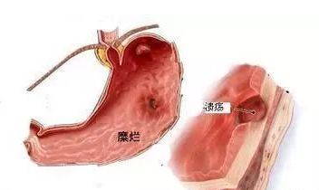 孕妇可以做胃镜检查吗多少钱