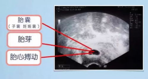 怀孕多少天后能在子宫孕囊中看到