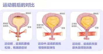 喂奶时可以进行盆底肌修复锻炼吗?