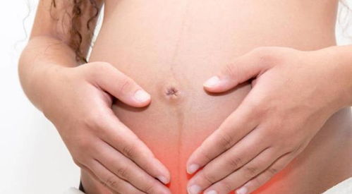 孕期分泌物多怎么办女性