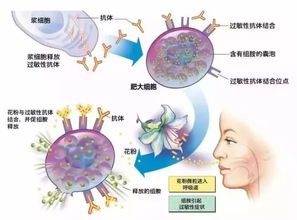 鼻炎怎么才能根治