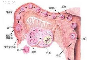 多囊卵巢综合症是怎么回事儿