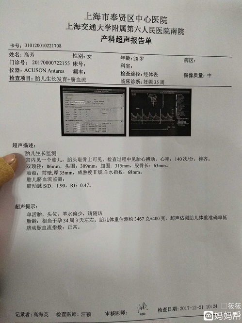 孕晚期羊水指数正常值范围