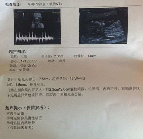 胎停孕是什么原因导致的