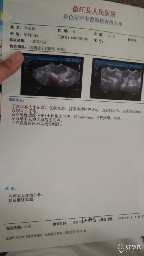 月经第13天卵泡多大正常值