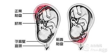 胎儿是否发动怎么看出来