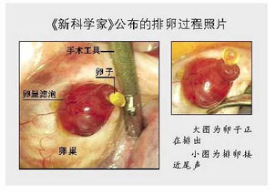 促卵泡发育的中药方子要吃的久