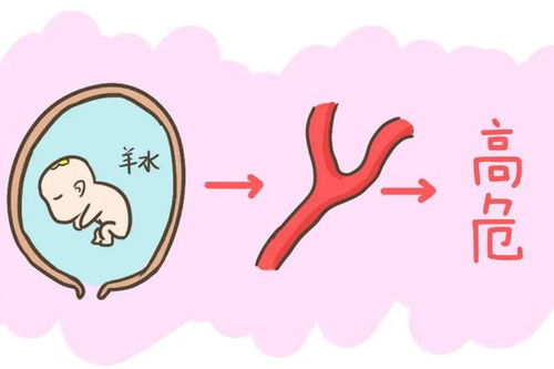 胎盘早剥和羊水有关系吗孕妇