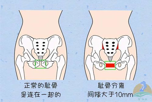 孕妇什么时候补钙好