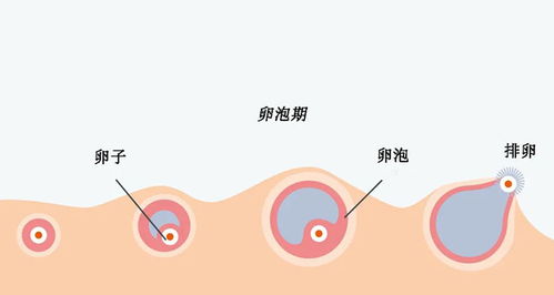 取卵后尿痛正常吗