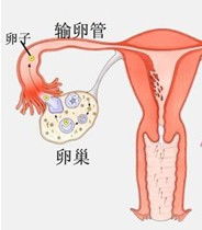 孕前怎么预防怀孕反应大