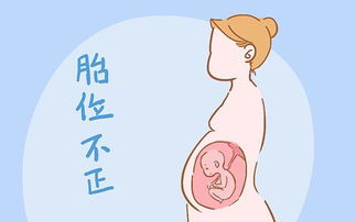 孕妇为什么会胎位不正