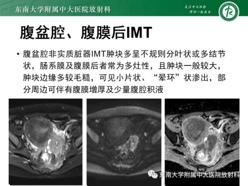 请问医生得了早期肺癌还能治愈吗？有多大的把握