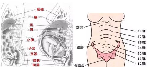 骨盆窄的孕妇可以顺产吗产可以吗