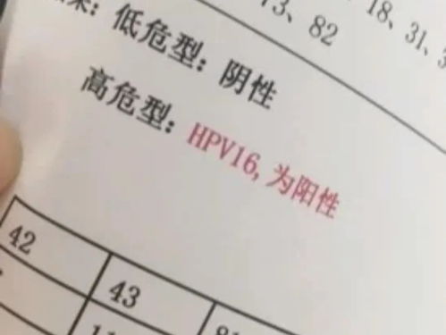 男性hpv检查多久出结果