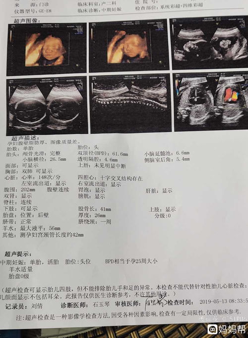 B超做多对宝宝有影响吗？