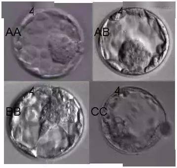 囊胚着床不成功胚胎会流出来吗