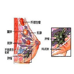 女生吃什么对乳腺好