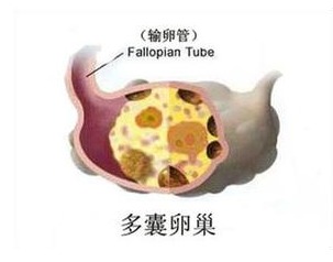 卵子排出后怀孕几率有多大