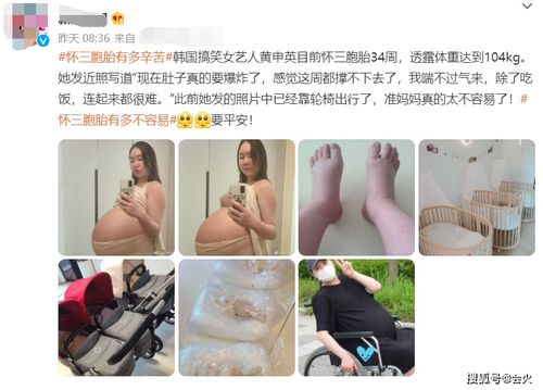 孕早期浮肿是怀女孩吗图片