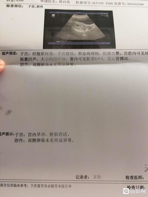 请问怀孕8周时孕囊到底有多大属于正常？